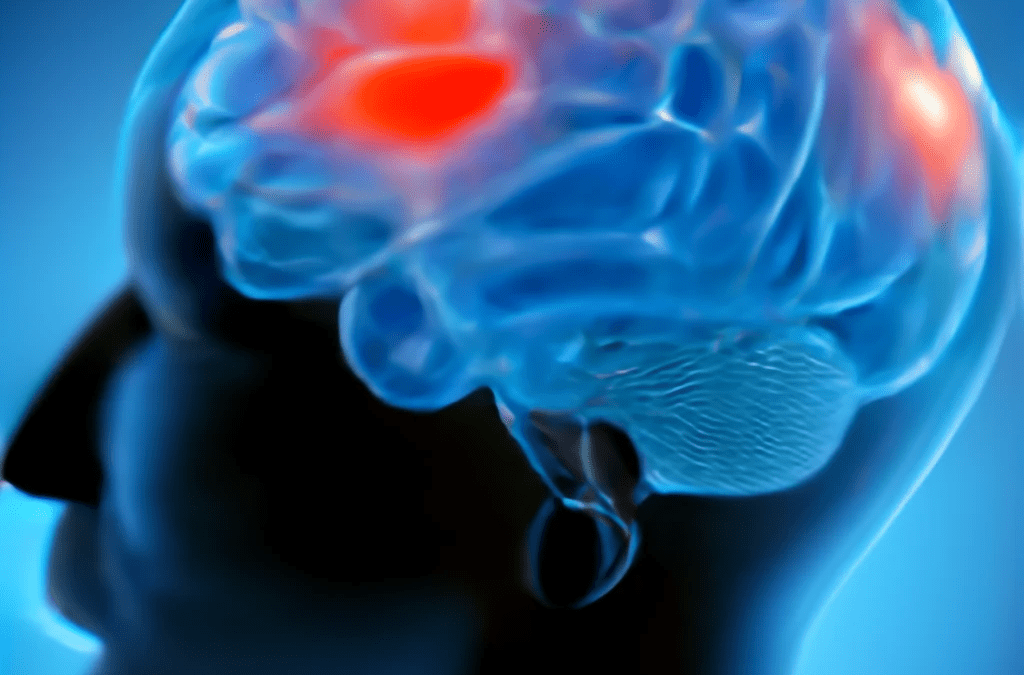 Problèmes cognitifs de « fibro-brouillard »