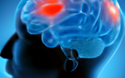 Problèmes cognitifs de « fibro-brouillard »