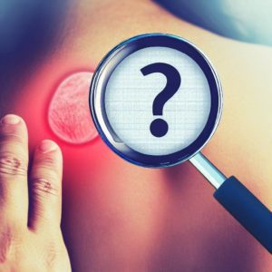 Les points sensibles de la fibromyalgie nous induisent-ils en erreur ? Une étude remet en question la prévalence des points sensibles de la fibromyalgie.