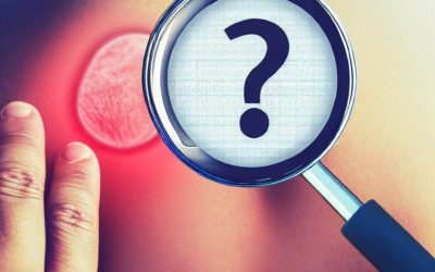 Fibromyalgie et points sensibles